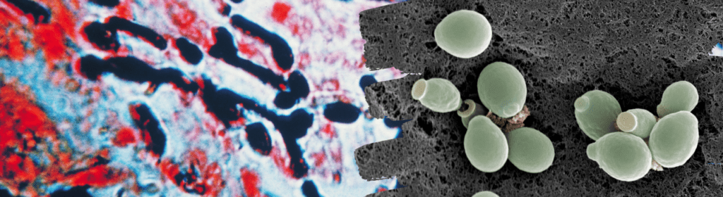 Cerveja: você sabe como é feita? 4 imagens de leveduras de cerveja feitas no microscópio